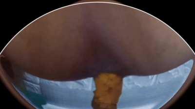 Eat the shit from my ass [F] #femscat #scatbook #nsfwtwt #nsfwtw #scat #poop #scatslut #scatporn #Poopgirls #asianmilf #milfasian #GirlsPooping #poopvids #scatvids #efro #scatasian #asianscat #milf