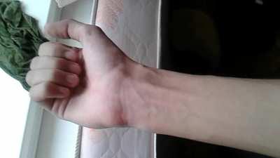 No, I actually have worms under my skin, here's nice demonstration. Just saw someone posted pictures of their wrist, but you can barely see any worms in it. The secret is you should feed them, by putting cum under your nails.