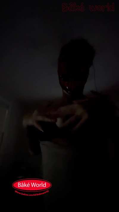 a vitiligo Halloween surprise n bake world