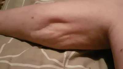 Thanks, I hate severe leg cramps