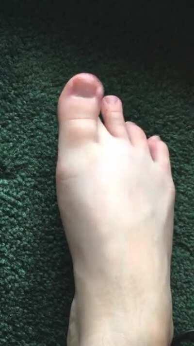 Natural foot