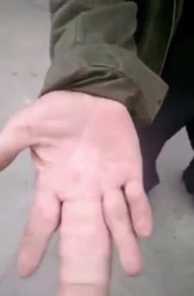 Absolute Unit of a finger