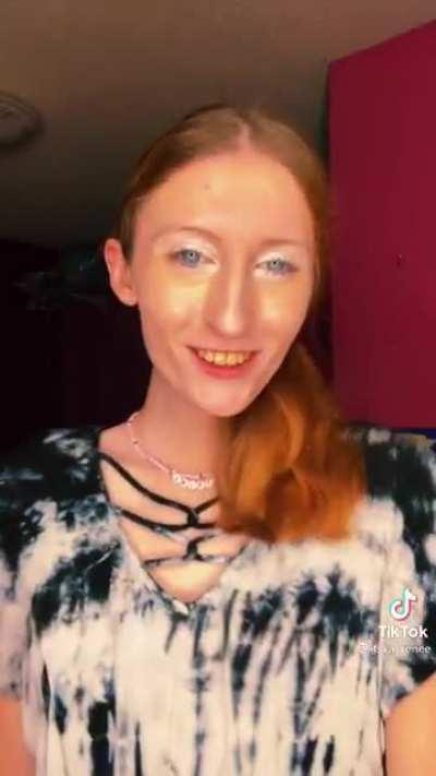 Should've eaten some Toothpaste 🤢