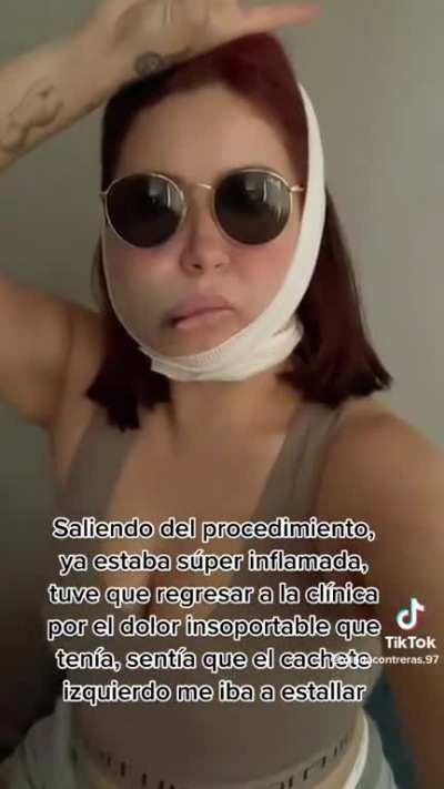 Girl went to have plastic surgery done on her face