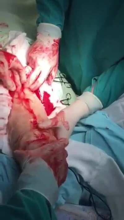 У вас мальчик