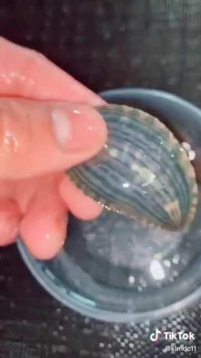 I want more attention for the leech person