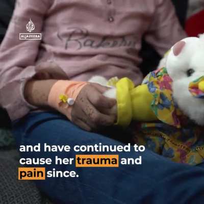 12-year-old girl, Mazyouna, face ‘ripped off’ after rocket strike. Israel blocks evacuation