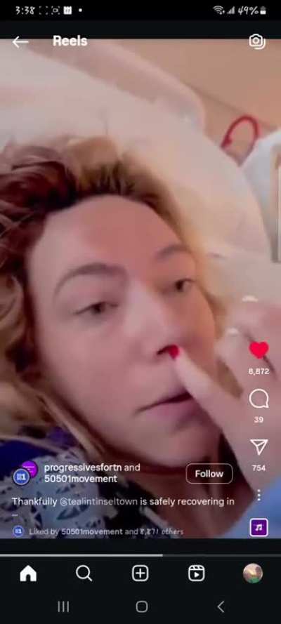 Woman who was trampled by the police horse speaks up