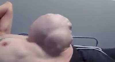 Hernias are terrifying