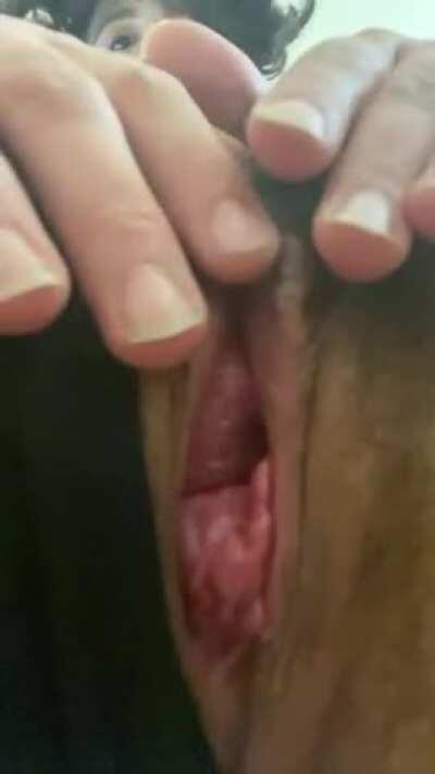 Let me ride your face with my after birth prolapse?