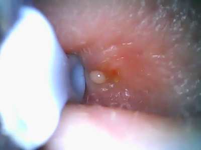 Ear pop round 2 part 1