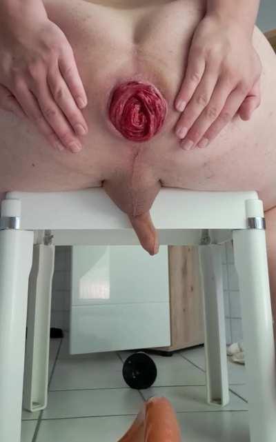 Prolapsing good enough to piss