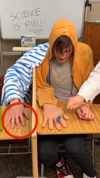 This body transfer illusion allows the person to feel psychological feelings on a fake limb