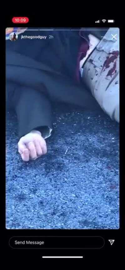 Cop gets beaten or the head with a stick by the walking dead then unloads a whole clip in him. “Back story was the guy on drugs and had crashed his whip”