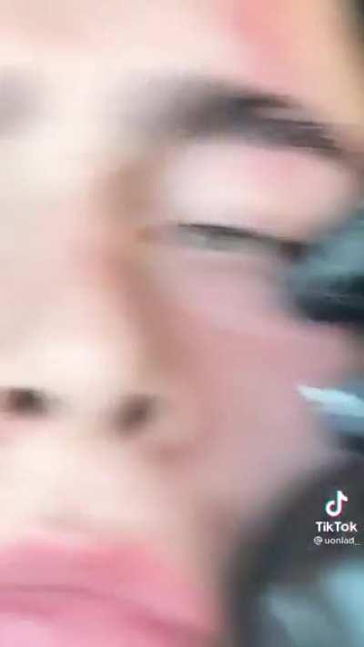 Uh yeah totally I uh. Got it in a bar fight.