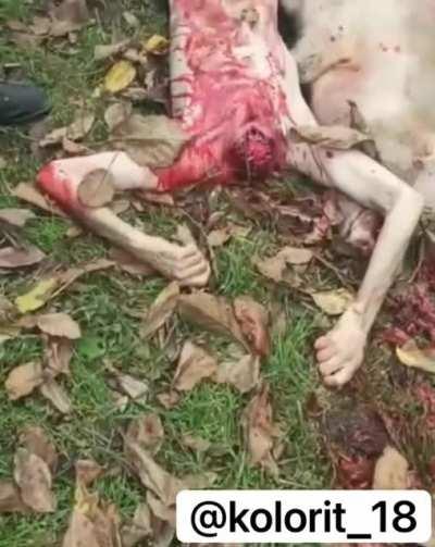 Azerbaijanis cut off the head of an Armenian