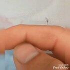 Give the mosquito hard time