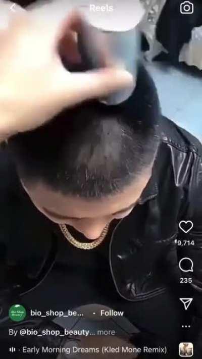 после чипирования имитируются волосы за счёт магнитного поля на башке