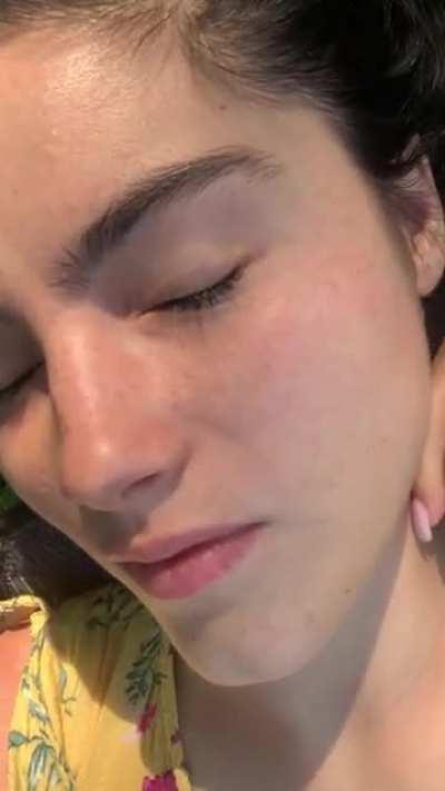 freckles in the sunlight