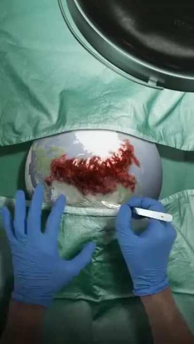 medical visualization of wars heppening in the world right now...