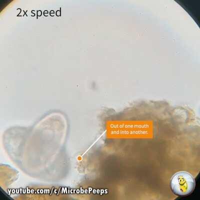 Vorticella's very bad day