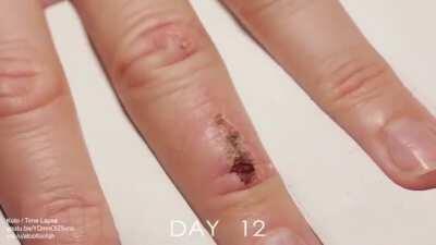33 days of wound healing