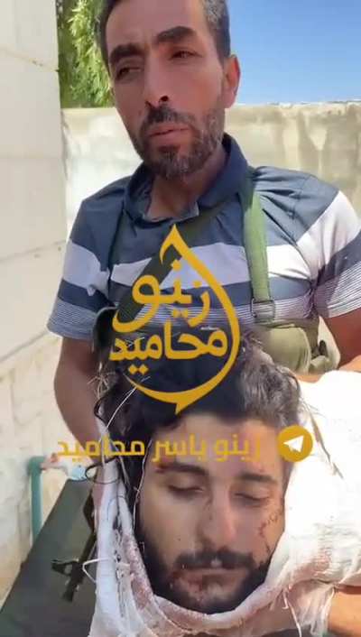 Tribeman head cut by druze in syria 19/7/2025