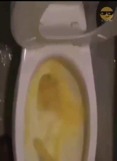 Answer to Item material