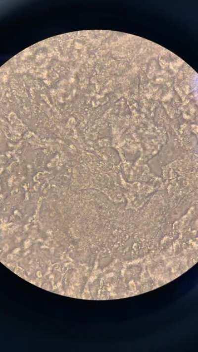 Beating cardic cells in culture. This is as close to magic as it gets 💛