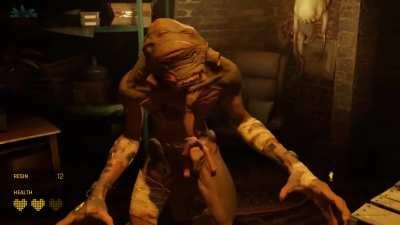 I have a brain injury