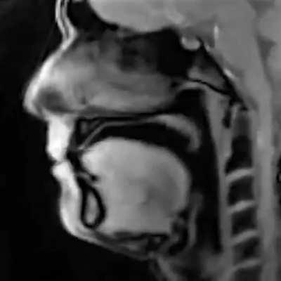 A real-time MRI scan of a person speaking. Credit: Jens Frahm / MPIBPC