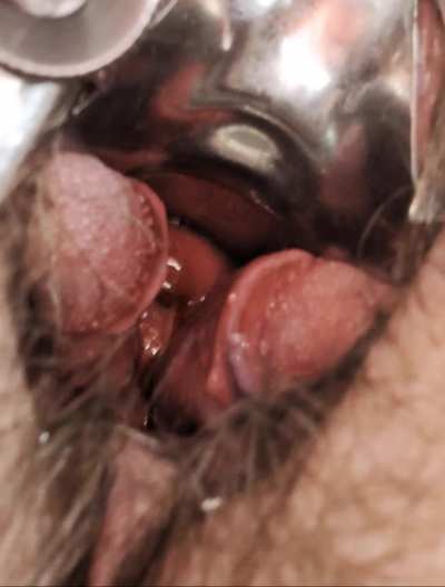 Showing off my best hole, with an even better hole on the inside.