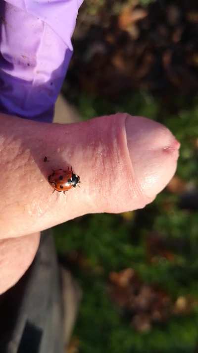 occupational hazards