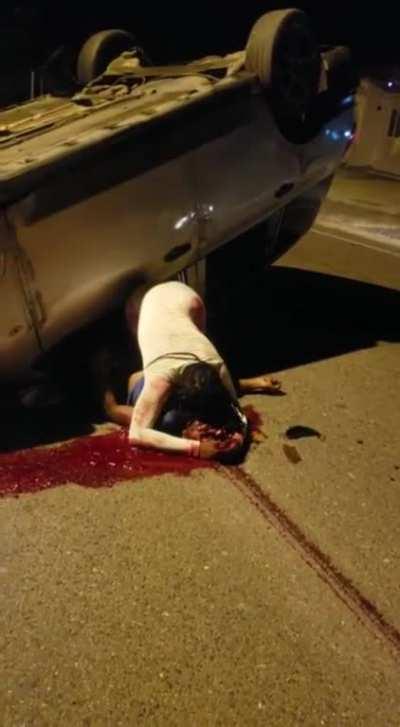 alot of people on r/eyeblech were asking for the vid so i posted it here if thats ok