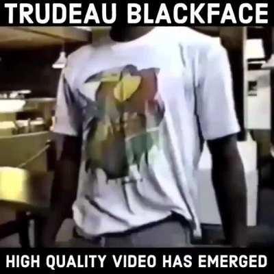 People who think COVID is a mild illness should look at what it has done to Justin Trudeau after only a couple days! It appears he has already gone psychotic and developed some kind of skin disorder.