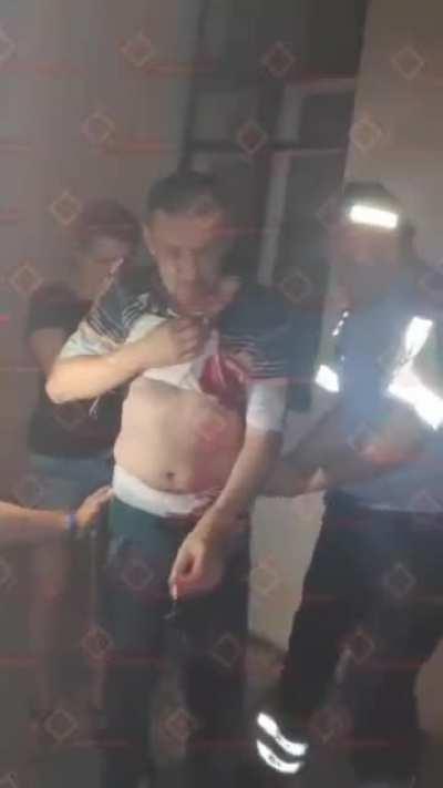 Belarussian protestor in Minsk smokes a cigarette with a bullet hole in his torso.