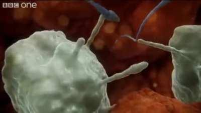 Sperm attacked by woman's immune system