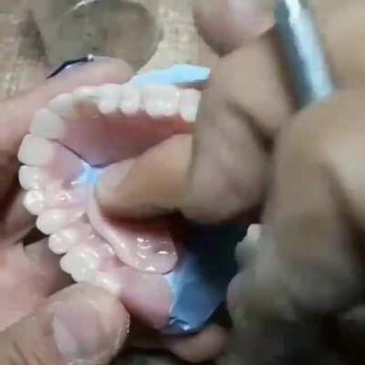 Satisfying repair of a fractured denture.