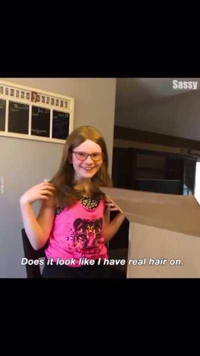 Девушка одевает парик, борясь с очаговым облысением.