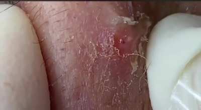 Part whatever of the previous series