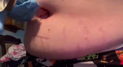 BBW girl navel stabbing [if You don't like,don't downvote,just ignore it :) ]