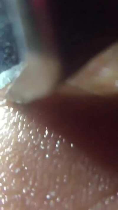 Try to remove small splinter on the feet