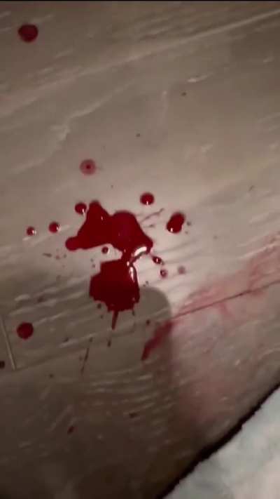 What the Police K-9s did to Pat last time.