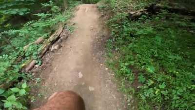 Two surgeries and four weeks into recovery. Wear shinguards and ride with friends!