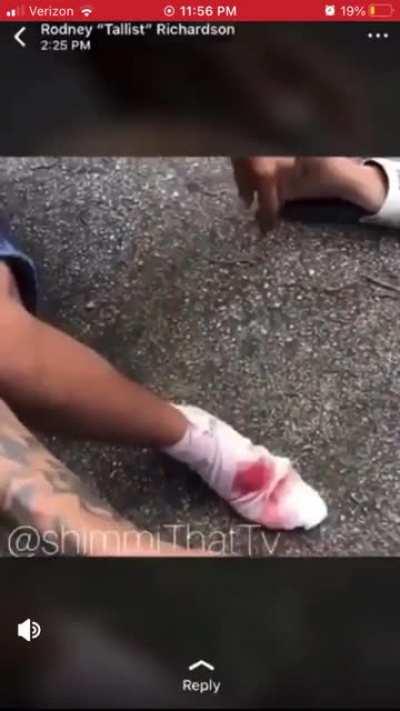 Foot Russian roulette