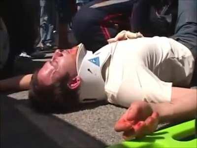 AAAAAAAAI, MINHA PERNA