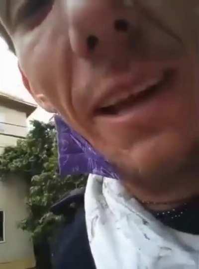 Seattle man shows off the plant he has growing out of an abcess in his leg