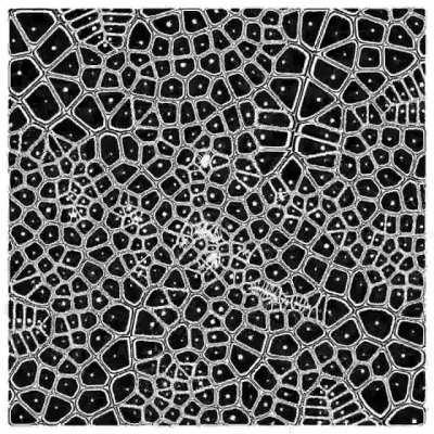 [possible EPILEPSY, take care] Fouronoi Diagram