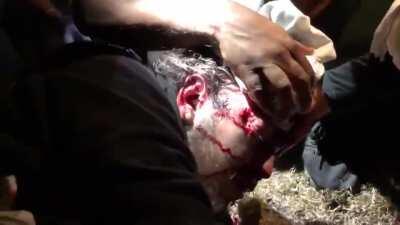 [Portland] 7/11/2020 Protester shot by impact munition last night. [graphic]