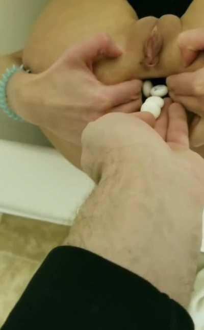 Mentos & Coke enema, what could go wrong